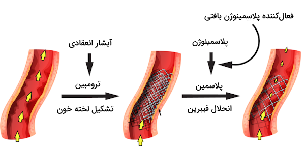 تشکیل لخته در رگ آسیب دیده و سپس انحلال فیبرین پس از بهبود آسیب