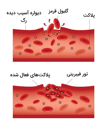 تشکیل لخته خون در محل زخم 