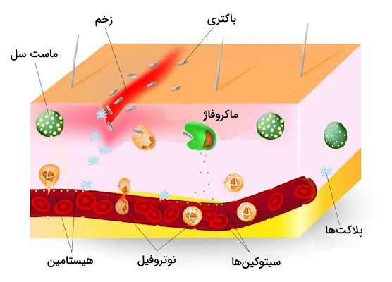 شکسته شدن سد دفاعی پوست به دلیل ایجاد زخم و شروع التهاب