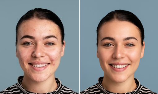 دو عکس از صورت یک زن خندان برای نشان دادن روتوش چهره و صاف کردن پوست با پرامپت چت جی پی تی 