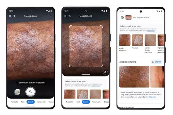 تصویر پوست دست انسان و تیرگی آن-گوگل لنز چیست