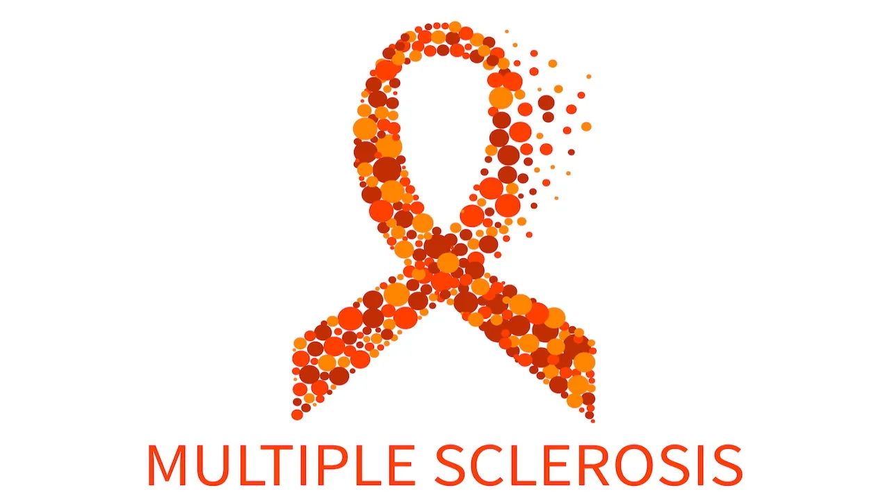 بیماری ام اس و علت ابتلا به آن چیست؟ — علائم و درمان Multiple Scelerosis چه هستند؟