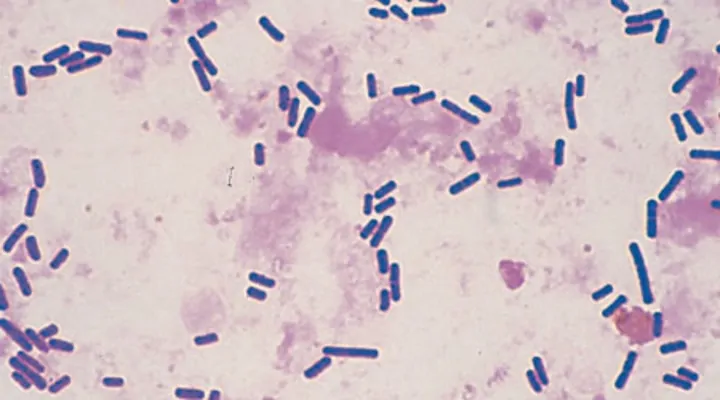 کلستریدیوم پرفرنژنس
