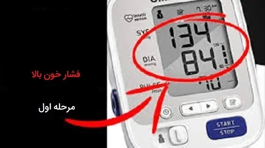 فشار خون بالای مرحله اول